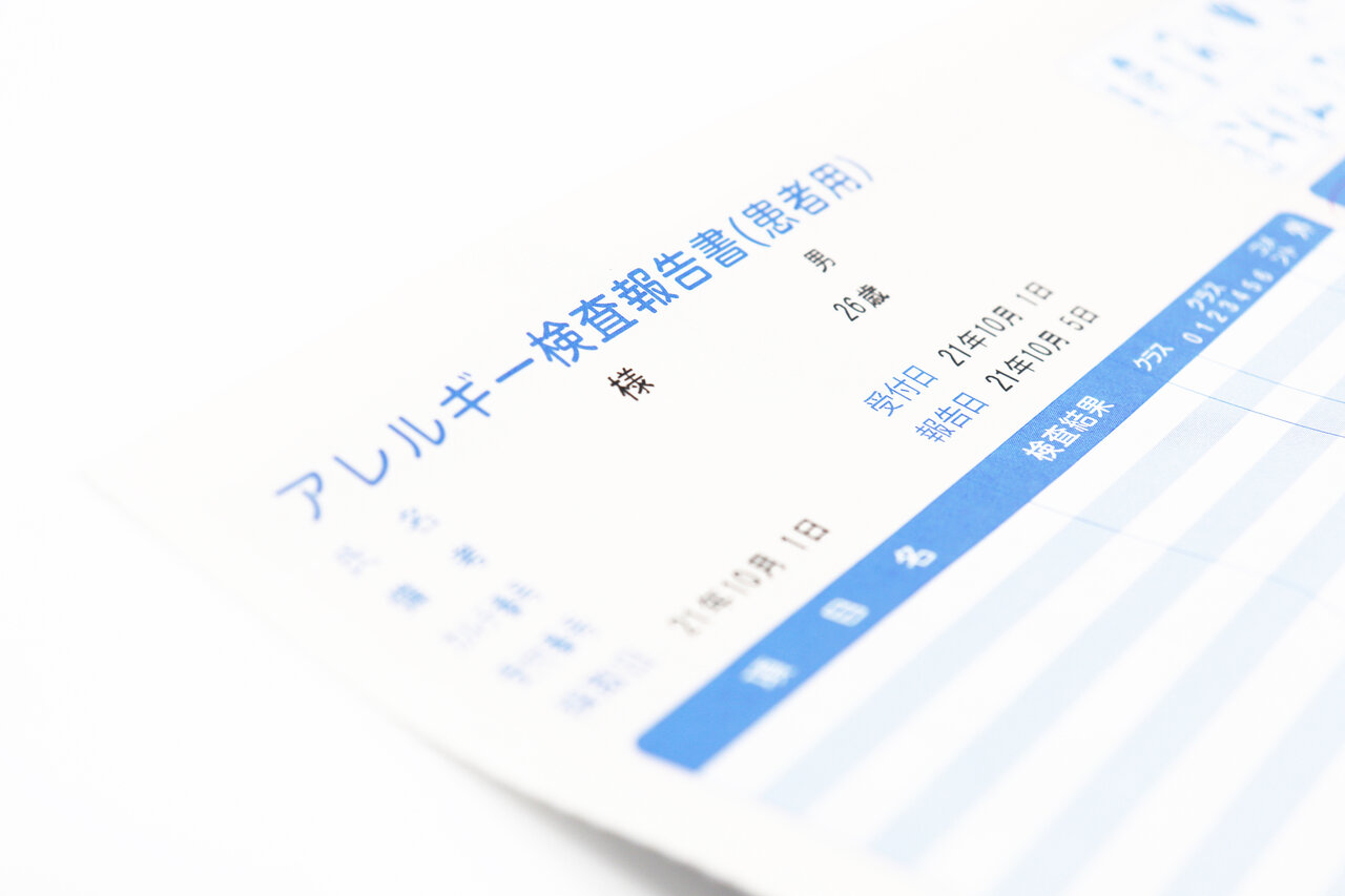 カバー画像:［医療提供体制］ アレルギー対策指針改正、28年度から3年ごとに検討　厚労省