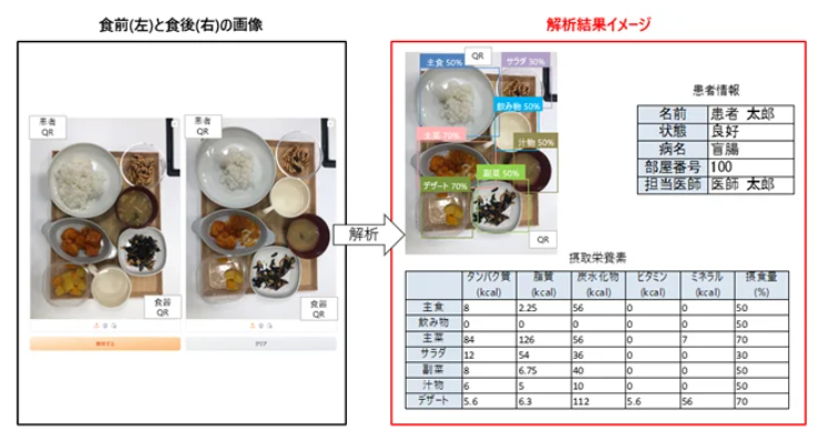 カバー画像:医療介護現場に「摂食量自動判定AI」