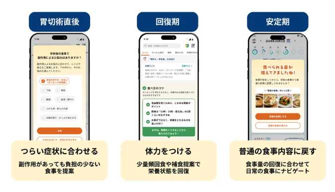 カバー画像:おいしい健康、胃がん切除術患者伴走支援に関する共同臨床研究を開始