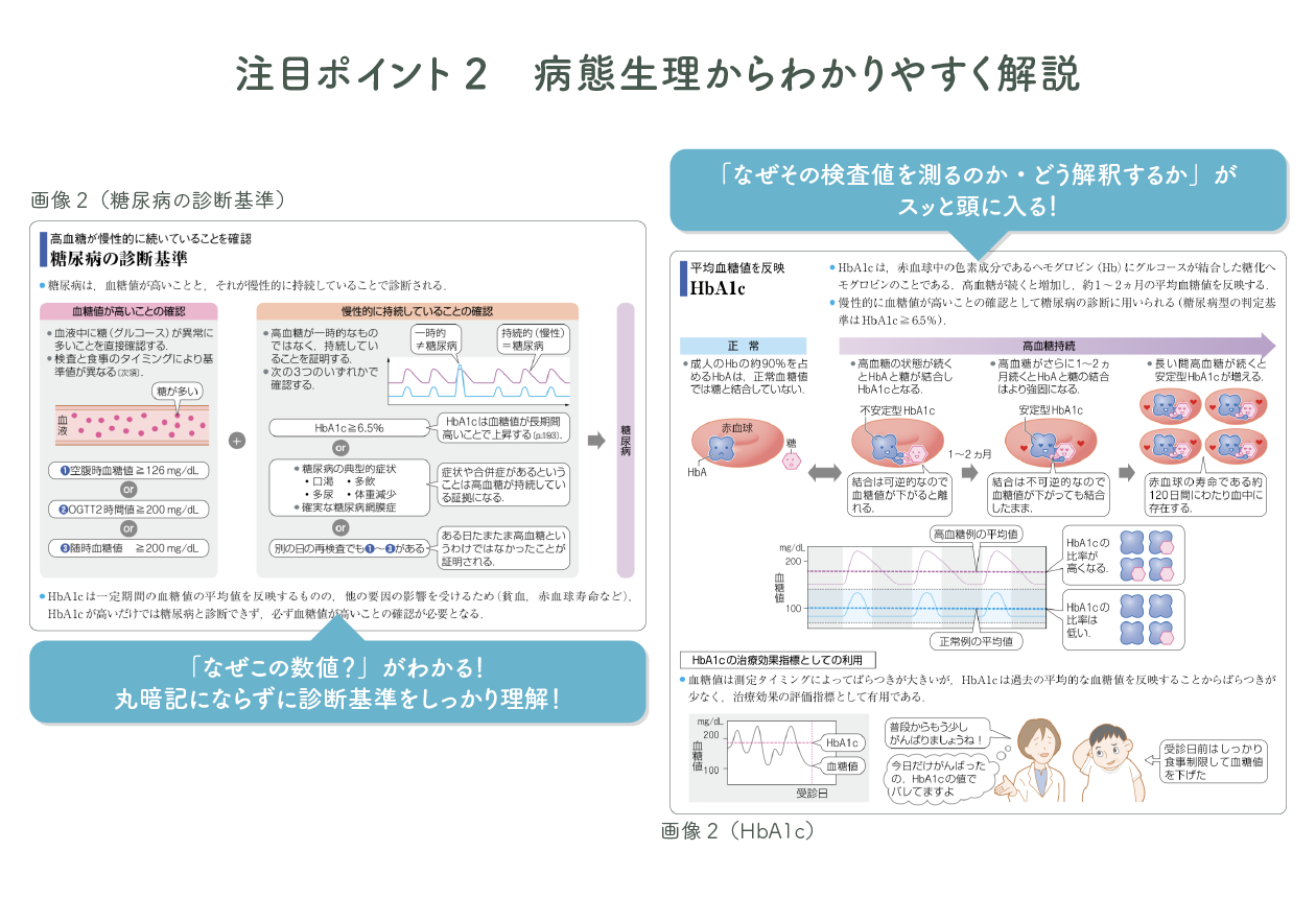 「なぜこの数値？」がわかる！丸暗記にならずに診断基準をしっかり理解！

「なぜその検査値を測るのか・どう解釈するか」がスッと頭に入る！